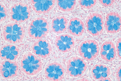 Blooming Barrier